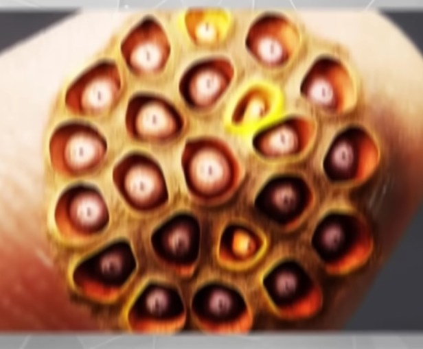 Picture of a human finger covered in holes with strange bumps in the middle.